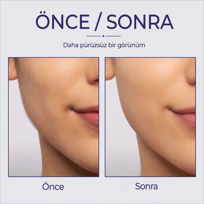 Belluva™ Hassas Tüy Temizleyici Smoothtouch